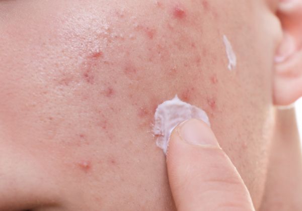 �������������й�ϵ�� ��������ε���